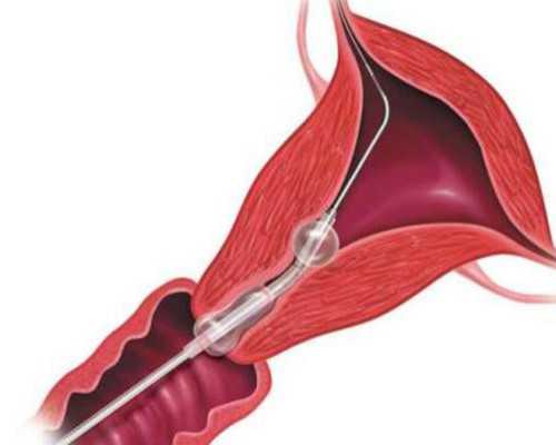 国内公立医院供卵多少钱,厦门妇幼可以做三代试管吗？