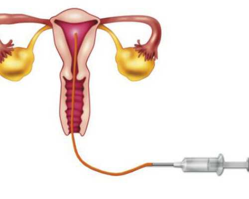 国内试管供卵包男孩多少钱,恩施做三代试管婴儿需要多少钱？最新价格公开！