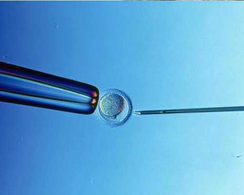 国内有哪些供卵中心医院,龙岩做试管婴儿需多少钱